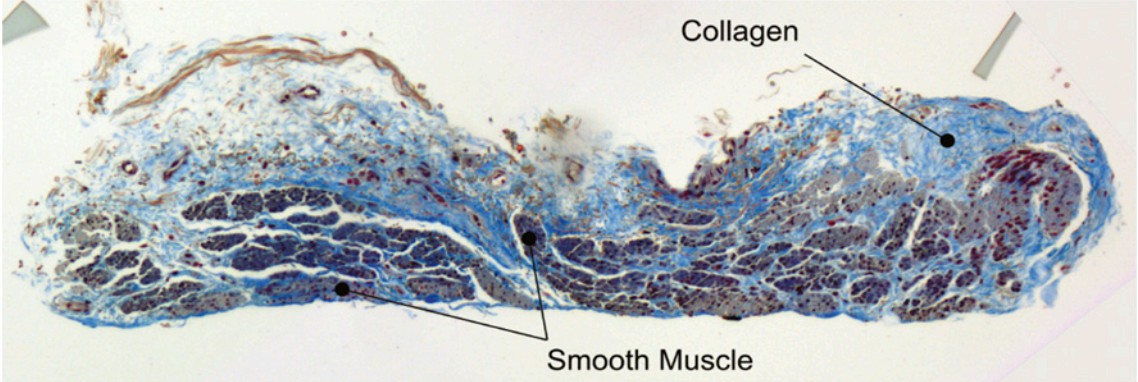 Airway smooth muscle tissue.